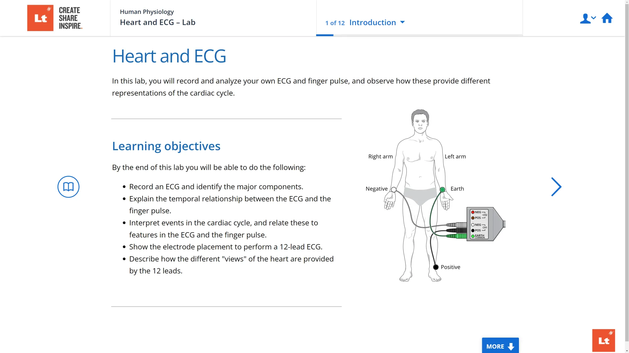 A screenshot of the Heart and ECG Lab in Lt showing a diagram of a man connected to ECG leads.