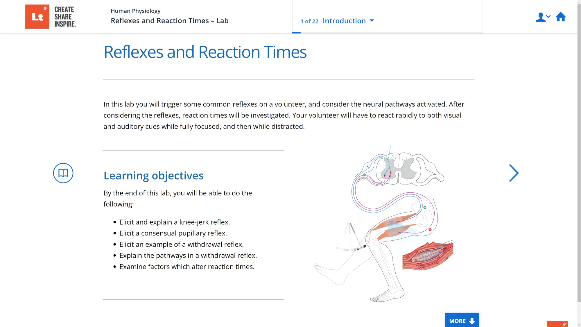 A screenshot of the Reflexes and Reaction Times Lab in Lt showing a diagram of the knee jerk reflex.