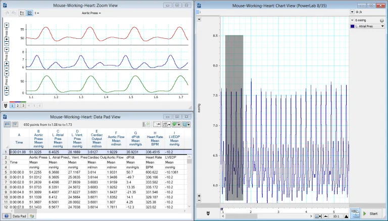 labchart readout of working heart