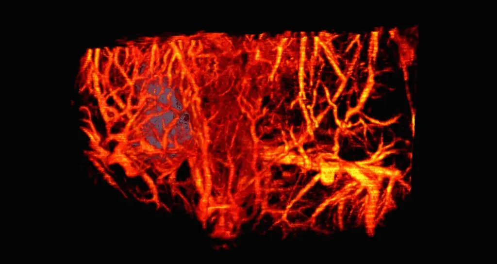 Tumor Vasculature