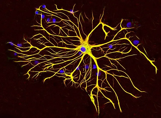 astrocyte stained with GFAP and vimentin