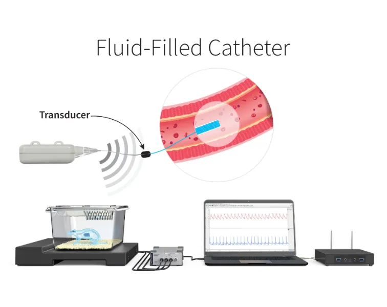 Fluid-Filled Catheter Technology for Telemetry