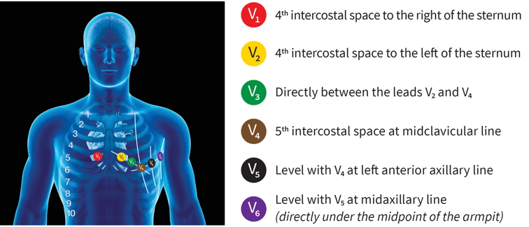 5 lead ecg placement